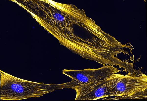 What is the Cytoskeleton and Its Functions? - Characteristics of the cytoskeleton