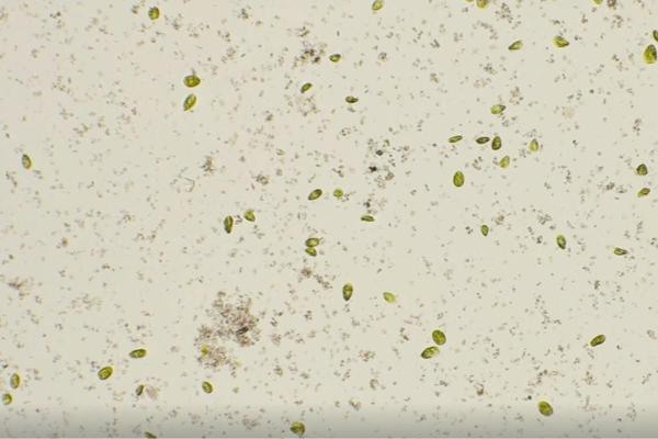 What Organisms Are Classified Into the Archaea Domain? - Examples of archaea