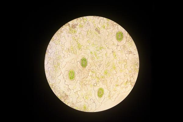 What Are Lysosomes? - Definition and Functions - Function of lysosomes