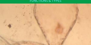 What Are Chromoplasts?