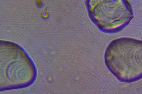What is a Leucoplast? - What are leucoplasts?