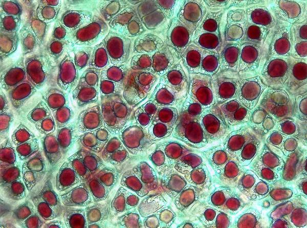 What Are Plastids in Plant Cells? - What are plastids in plant cells?