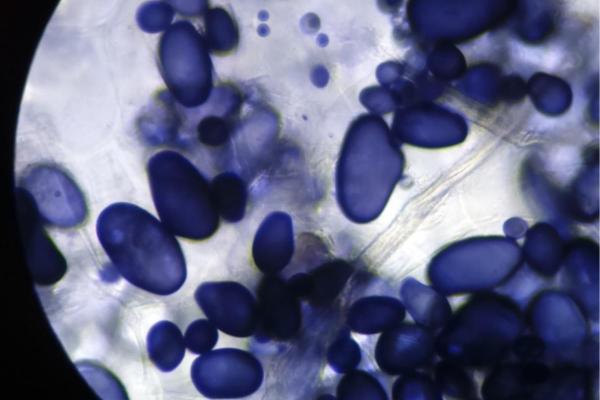 What Are Amyloplasts in Plant Cells? - What are the function of amyloplasts in plant cells?