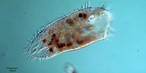 What Is a Protozoan in Microbiology?