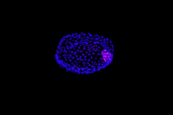 What Is a Stem Cell and What Does It Do? - What is a stem cell?